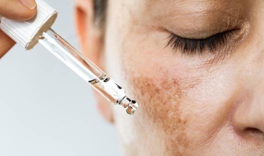 Dermatology