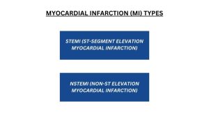 A Guide to Myocardial Infarction ICD-10 Codes